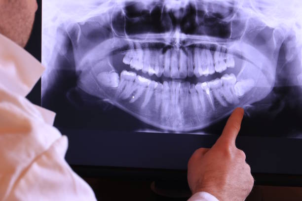 Best Urgent Dental Care for Toothaches in Mason Neck, VA